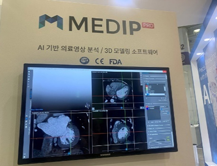 Automatic Body Composition Analysis Solution & Disease Monitoring Solution