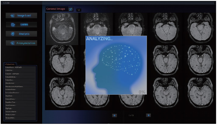 MRI-based Diagnostic Software