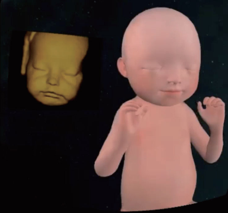 All-in-One VR Device (Ultrasonography)