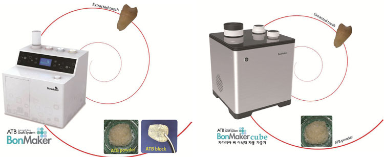 Dental Bone-Graft Machine