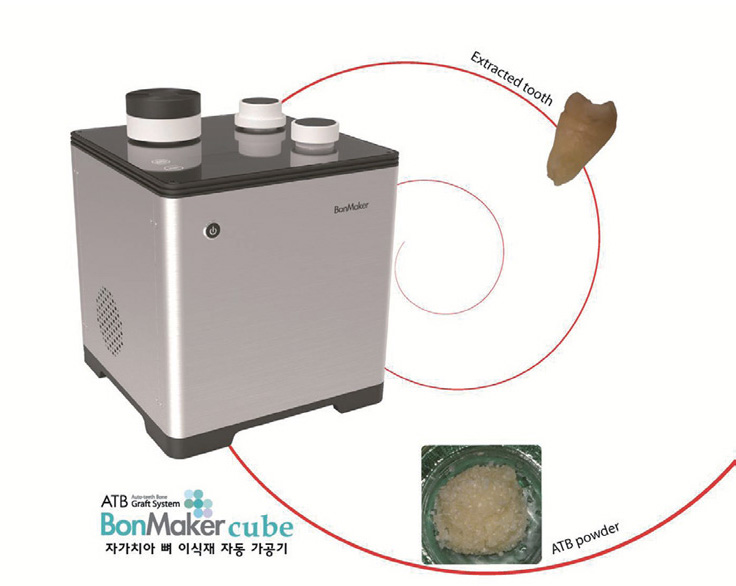 Dental Bone-Graft Machine