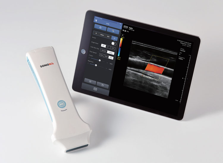 Handheld Wireless Ultrasound Diagnosis System