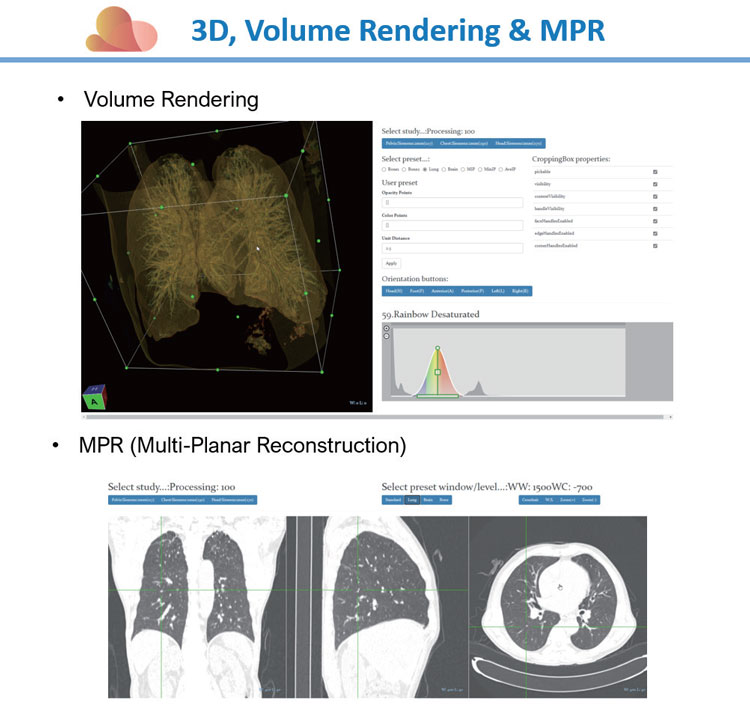 Cloud-based PACS Solution
