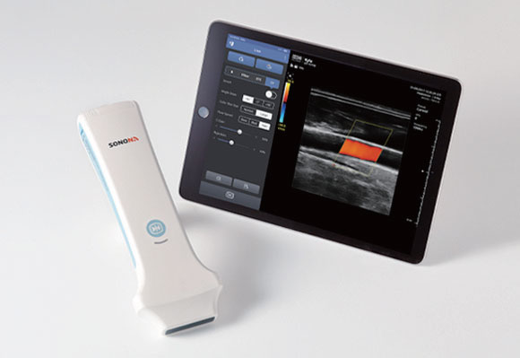 Wireless Portable Ultrasonic Diagnosis Device