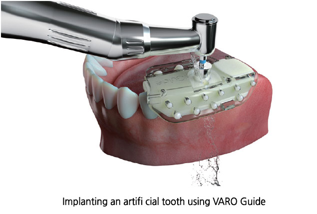 One Day Digital Guide(VARO Guide)