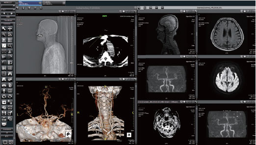 Medical Image and Information Management Solution