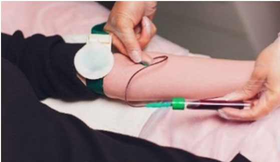 Non-contact Vein Viewer System